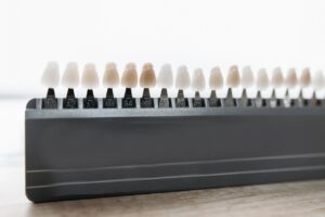 Photo by Pavel Danilyuk: https://www.pexels.com/photo/lined-up-veneers-on-display-6812501/ – veneers on display for color variations