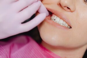 Image URL: Photo by Karola G: https://www.pexels.com/photo/a-person-wearing-latex-gloves-checking-a-woman-s-teeth-6627526/ Alt Text: a smiling patient beginning her gum recession treatment