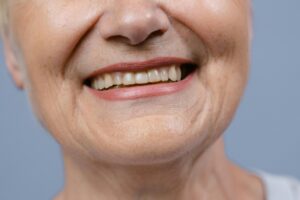 Photo by Tima Miroshnichenko: https://www.pexels.com/photo/close-up-shot-of-a-smiling-woman-8727478/ Old woman smiling with tooth-colored fillings