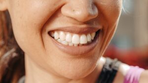 https://www.pexels.com/photo/close-up-photo-of-person-s-smile-7298633/ woman with dental implants smiling
